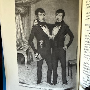 Op de afbeelding: Een historische zwart-witillustratie van siamese tweelingen uit 1839, afgebeeld staand naast elkaar in formele donkere pakken met vlinderdassen. Een van de tweelingen houdt een klein boekje vast. De tekst eronder luidt: The Siamese twins in 1839. The booklet displayed was sold.