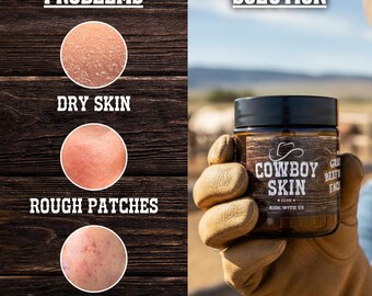 Handmade Grass-Fed Beef Tallow Cream: Eczema Relief, Dry Sensitive Skin