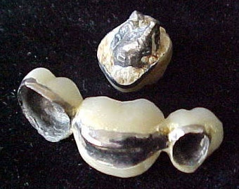 Dental Scrap 6.35 DWT 10.2 Grams White Gold Platinum Palladium heavy