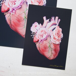 May include: A realistic painting of a human heart with pink roses growing from it. The heart is painted in shades of red and pink, and the roses are a soft pink. The background is black.