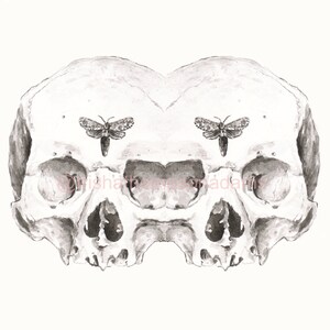 Siamese Skulls Print 5x7 Anatomical Giclee Art image 2
