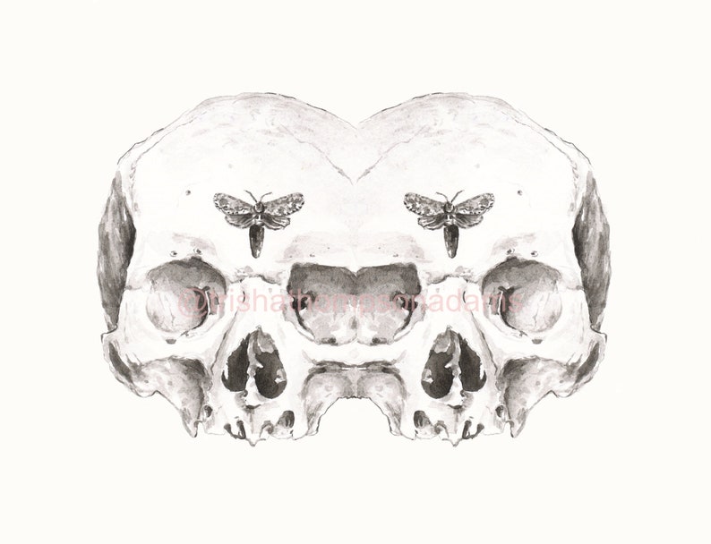 Siamese Skulls Print 5x7 Anatomical Giclee Art image 2