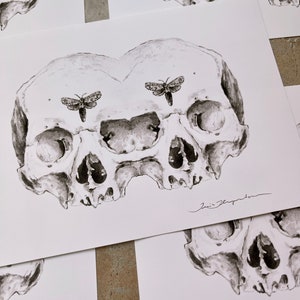 Siamese Skulls Print 5x7 Anatomical Giclee Art image 4