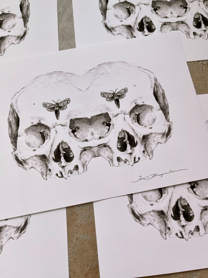 Siamese Skulls Print 5x7 Anatomical Giclee Art image 4