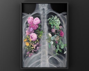 Pneumoflora X-Ray Floral Lungs Anatomy Print of Oil Painting - Anatomical Art Print - Human Body - Medical Art