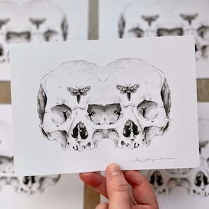 Siamese Skulls Print 5x7 Anatomical Giclee Art image 1