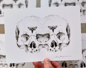 Siamese Skulls Print 5x7 Anatomical Giclee Art