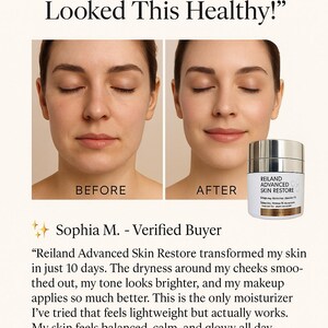 May include: Image shows a customer review for Reiland Advanced Skin Restore. The review includes before and after photos of a person's face, along with text stating the product reduced dryness, improved skin tone, and provided a smoother texture.