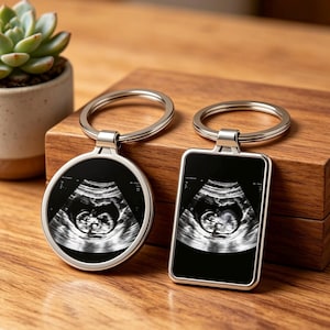Op de afbeelding: Twee metalen sleutelhangers met een zwart-wit echografiebeeld van een foetus. De ene sleutelhanger is rond en de andere rechthoekig, beide bevestigd aan zilverkleurige ringen. De echografie toont de duidelijke omtrek van een foetus.