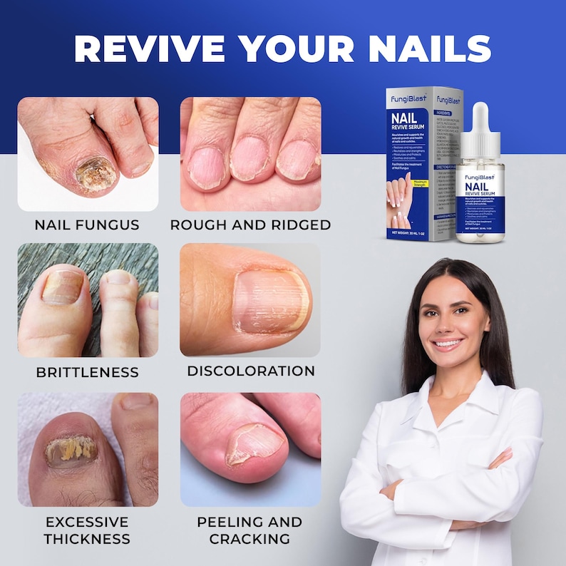 May include: An advertisement for a nail serum, featuring images of unhealthy nails with conditions like fungus, discoloration, and brittleness. The product is called "Nail Revive Serum" by FungiBlast. A woman in a white coat smiles in the bottom right corner.