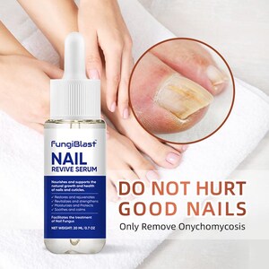 May include: A clear bottle of FungiBlast Nail Revive Serum with a dropper, next to a close-up of a toenail affected by nail fungus. The bottle is labeled with product details and the text "DO NOT HURT GOOD NAILS".