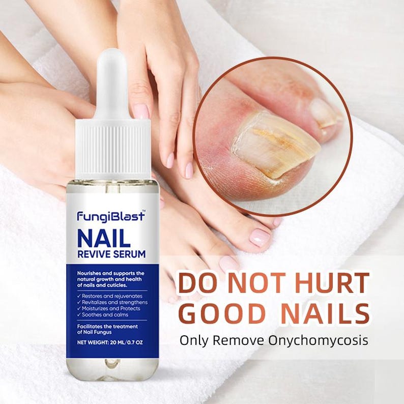 May include: A clear bottle of FungiBlast Nail Revive Serum with a dropper, next to a close-up of a toenail affected by nail fungus. The bottle is labeled with product details and the text "DO NOT HURT GOOD NAILS".
