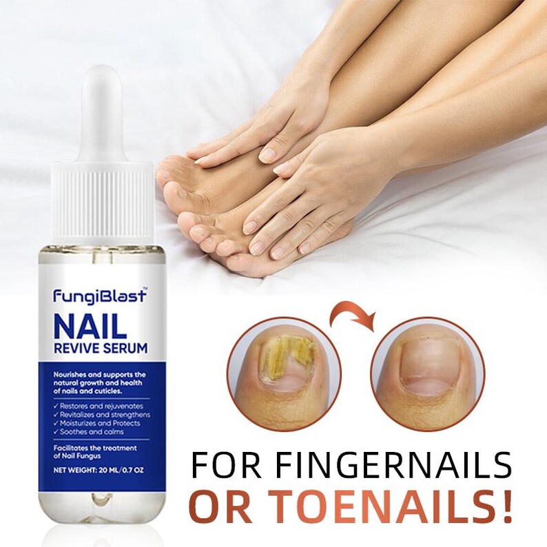 May include: A bottle of FungiBlast Nail Revive Serum with a dropper, next to a foot and hand. The product promises to nourish and support nail health. The image also shows before and after nail fungus treatment.