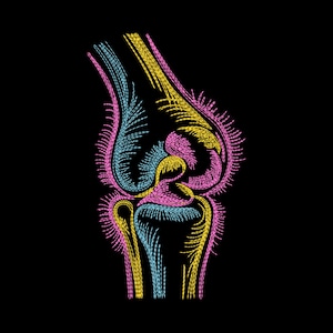 May include: A colourful, stylized illustration of a knee joint against a black background. The image shows the knee's structure in pink, yellow, and blue, highlighting the bones and tissues. The design is detailed and anatomical.