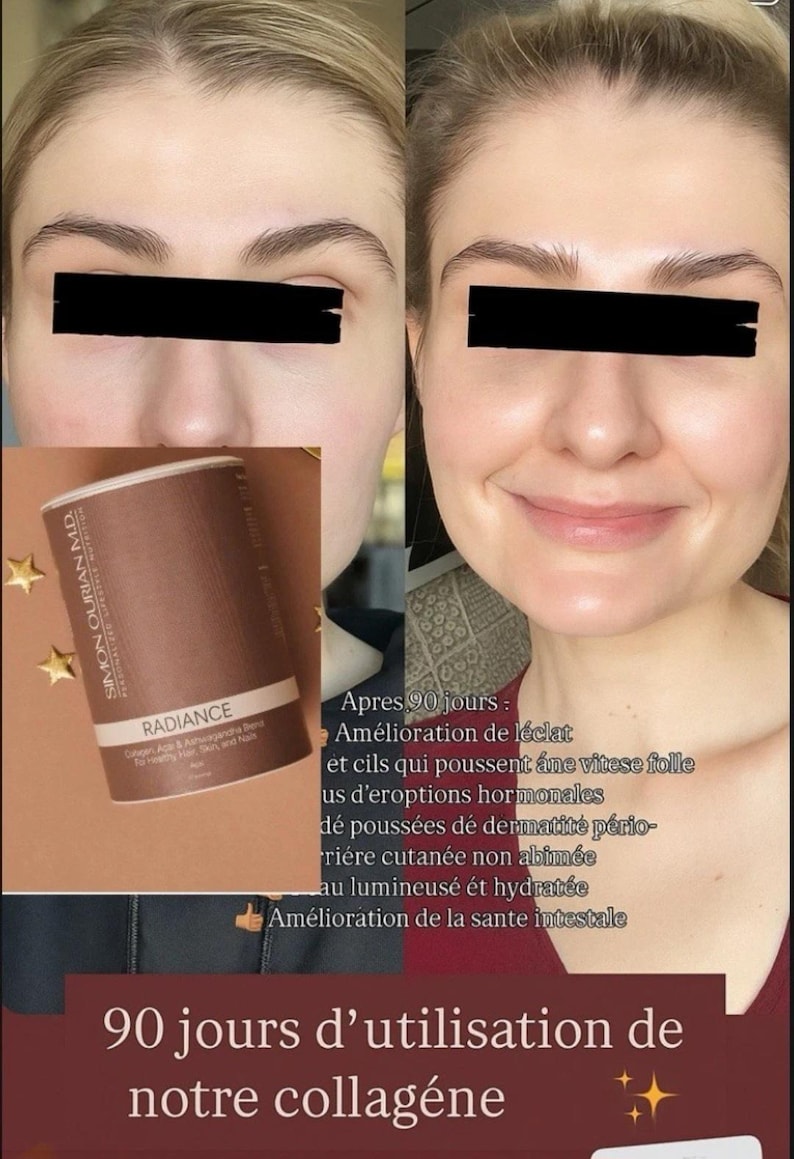 May include: A brown cylindrical container of Simon Ourian M.D. Radiance Collagen, Ashwagandha, and A&ccedil;a&iacute; blend. The image features a before and after comparison of a face, with French text overlay describing 90 days of use and skin improvements.