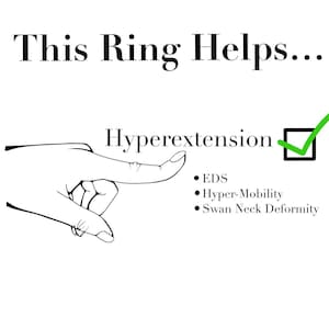 May include: A black and white illustration with the text "This Ring Helps..." and "Hyperextension". A hand points to the word "Hyperextension" with a green tick. Additional text includes "EDS", "Hyper-Mobility", and "Swan Neck Deformity".