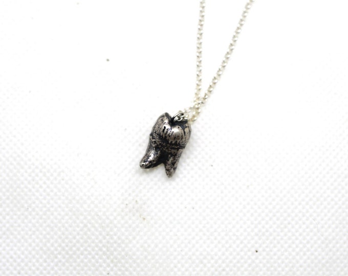Sterling cast tooth 2