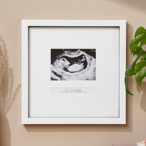 Może przedstawiać: Biała ramka ze zdjęciem czarno-białym z USG w środku. Pod zdjęciem znajduje się tekst "Baby Buchanan We can't wait to meet you".