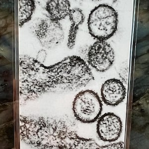 May include: A black and white abstract art print featuring circular and amoeba-like shapes. The print has a textured appearance, with varying shades of gray and black against a white background. The artwork is encased in a clear protective sleeve.