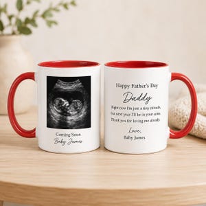 Puede incluir: Dos tazas de cerámica blanca con interiores y asas rojas. Una taza presenta una imagen de ultrasonido y el texto "Coming Soon Baby James". La otra taza dice "Happy Father's Day Daddy" con un mensaje de "Baby James".