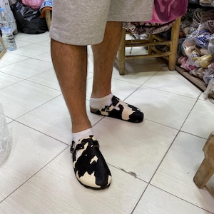 May include: Black and white cowhide clogs with a buckle closure. The clogs have a rounded toe and a thick sole. The person is wearing white socks and gray shorts. The clogs are a unique footwear choice.