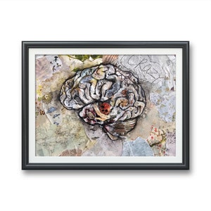 Cortical Contemplation- Anatomic Human Brain, Original Illustration Artwork dark fantasy realistic organ brain disease neurology