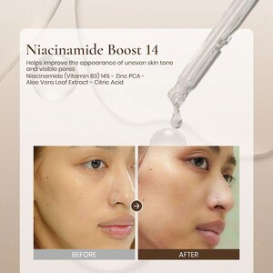 Niacinamide Face Serum for Balancing, Smoother, Even-Looking Skin – Niacinamide Boost 14 | Ruby Vibe Co image 8