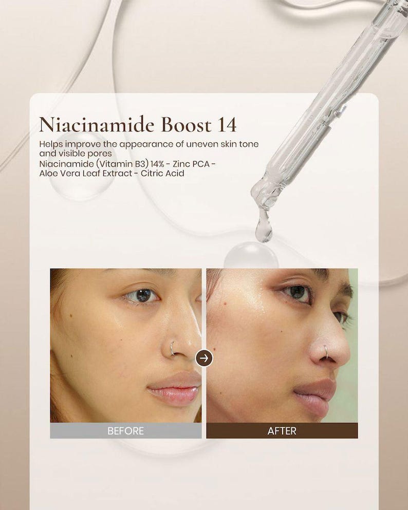 Niacinamide Face Serum for Balancing, Smoother, Even-Looking Skin – Niacinamide Boost 14 | Ruby Vibe Co image 8