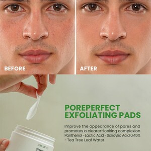 May include: Image shows a before-and-after comparison of a person's face, highlighting skin improvement. Below, a white jar of "POREPERFECT EXFOLIATING PADS" is held with a cotton pad. The text on the jar and the background details the product's benefits.