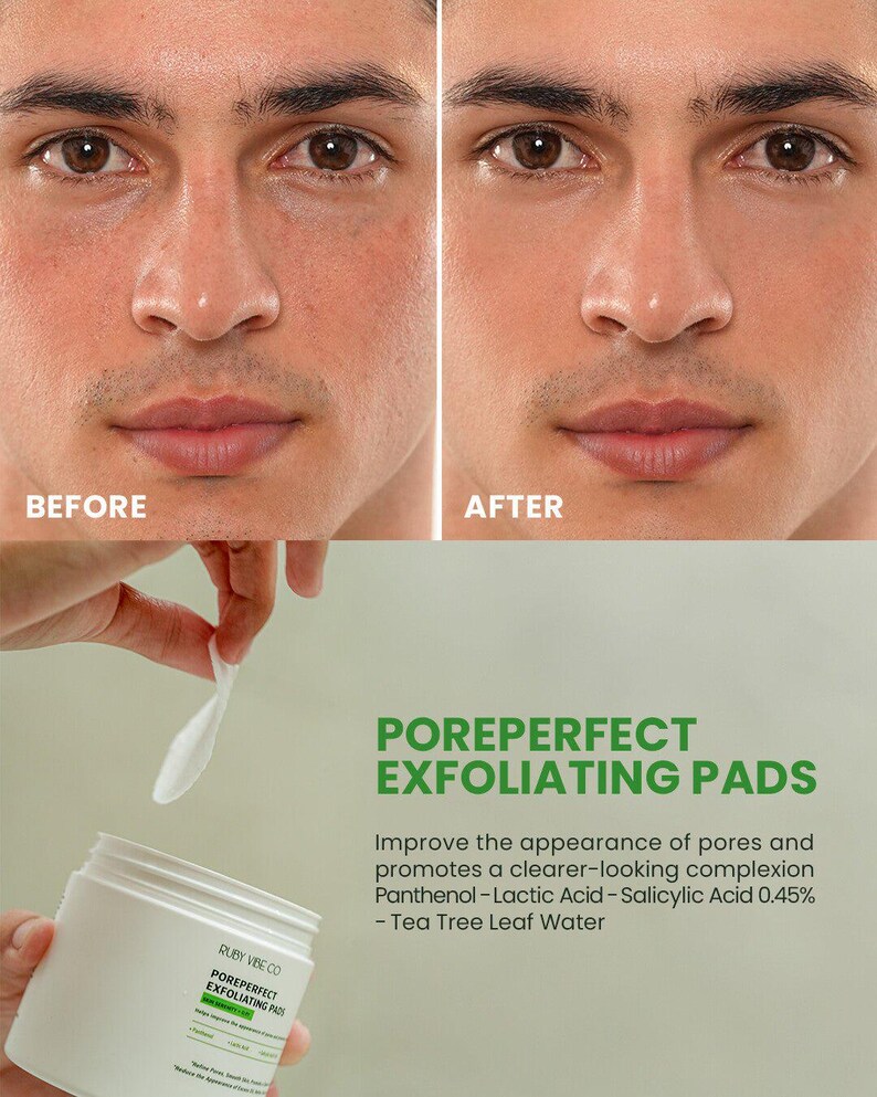 May include: Image shows a before-and-after comparison of a person's face, highlighting skin improvement. Below, a white jar of "POREPERFECT EXFOLIATING PADS" is held with a cotton pad. The text on the jar and the background details the product's benefits.