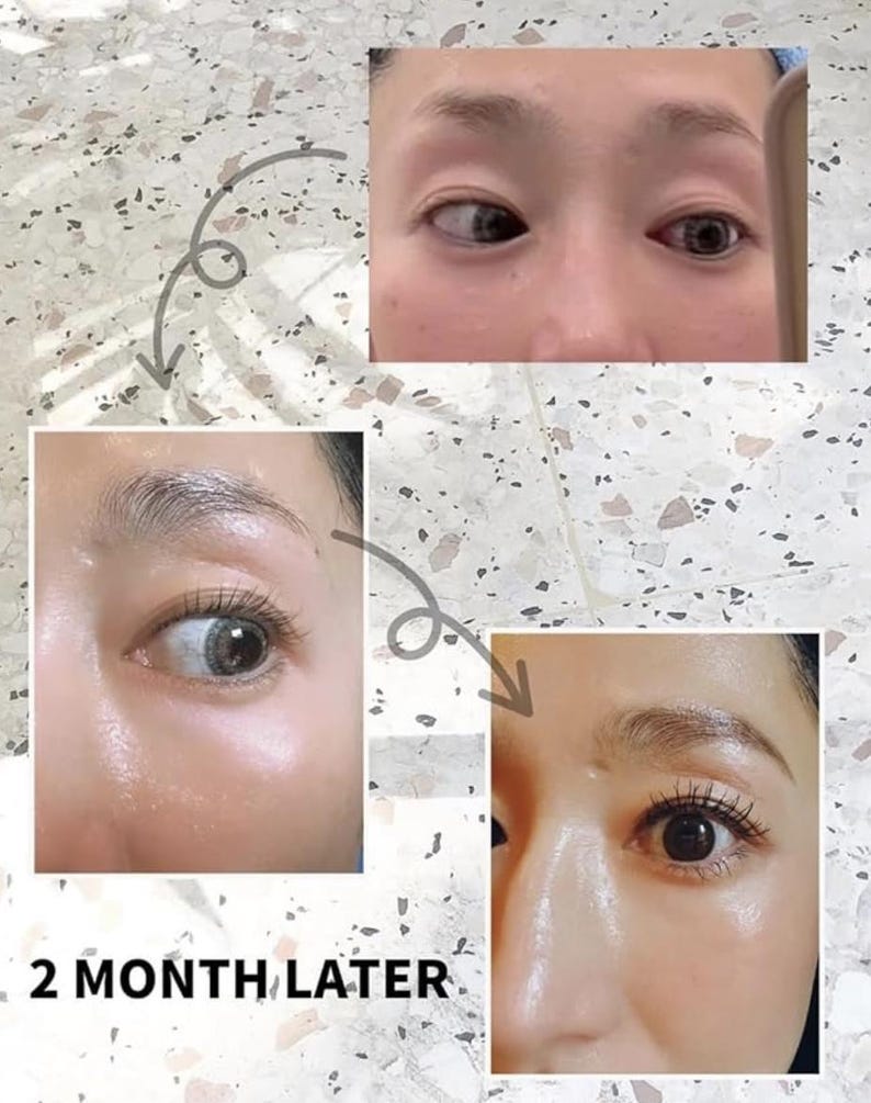 Lash Fusion Eyelash Growth Serum | Natural Vegan Lash Serum for Longer, Stronger Lashes image 3