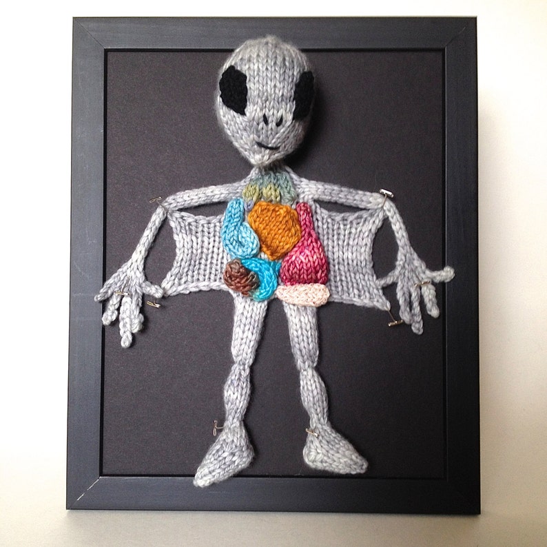 Knitted Alien Autopsy: Framed with Black Background image 1