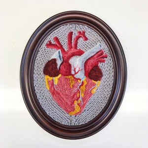 The Human Heart: An Anatomical Illustration in Wool