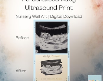 Stampa personalizzata per ecografia del bambino / Ricordo personalizzato della gravidanza / Decorazione murale per la cameretta dei bambini / Download digitale