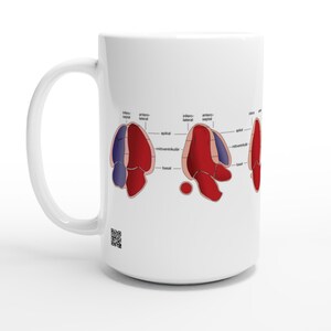 Op de afbeelding: Een witte keramische mok met een medisch diagram van de hartanatomie in rood en blauw. De illustratie toont dwarsdoorsneden met labels zoals infero-septal, antero-lateral, apikal, mittventrikulär en basal. Een kleine QR-code is onderaan afgedrukt.