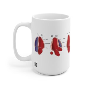 Könnte beinhalten: Weißer Keramikbecher mit einem Herzdiagramm in Rot und Blau, beschriftet mit anatomischen Begriffen. Der Becher hat einen gebogenen Griff und eine glänzende Oberfläche. Das Design enthält Text wie "infero-lateral" und "apikal".