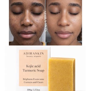 Kojic Acid Turmeric Soap Bar, Skin Brightening, Even Tone, Spotless Skin