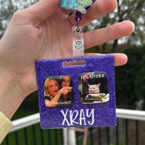 May include: A purple glitter badge holder with the word "XRAY" in white. It features two meme images, one with the text "It's fractured!" and the other with "It's Broke". A green and purple alien-themed charm is attached.