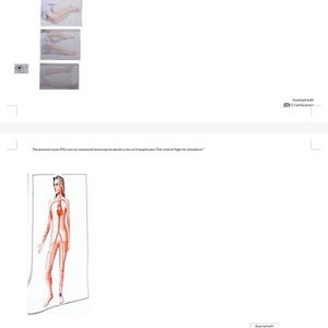 May include: Medical illustration of a human figure with the circulatory system highlighted in red. The image also includes a series of photos showing leg positioning and text about medical procedures. The image is scanned with CamScanner.