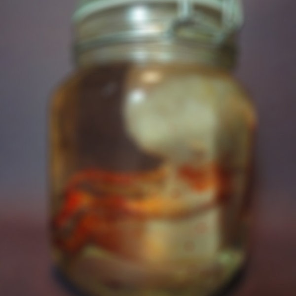 MATURE: Fetus in a Jar