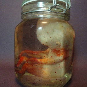 MATURE: Fetus in a Jar