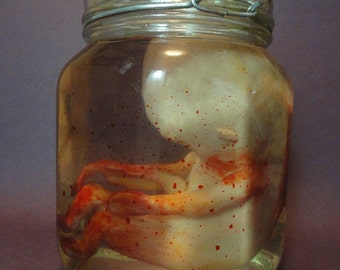 May include: A clear glass jar with a metal lid contains a preserved human fetus in a liquid with red spots.