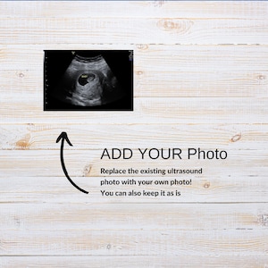 Editable Little Sister Pregnancy Announcement Floral Canva Template (Digital Download)
Girl Pregnancy Announcement Digital, Girl Gender Reveal, Floral Baby Announcement, Social Media Reveal Template, Its a Girl, Little Sister
Fall Girl Pregnancy Announcement: Little Sister Reveal (Digital Download)
Baby Sister Announcement Template | New Sibling Reveal | Pink Floral Reveal | Editable Canva | Digital Download
