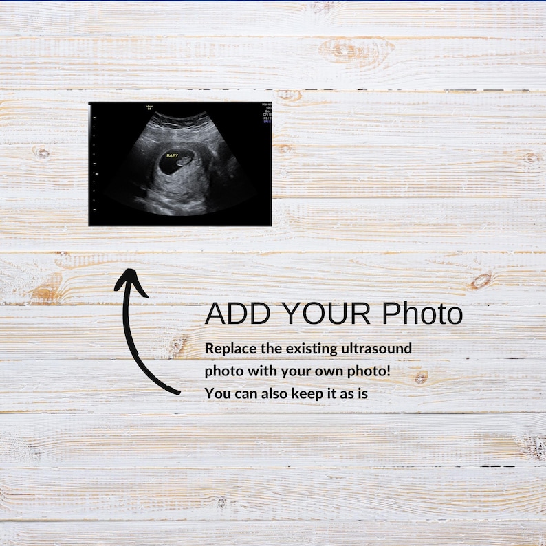 Editable Little Sister Pregnancy Announcement Floral Canva Template (Digital Download)
Girl Pregnancy Announcement Digital, Girl Gender Reveal, Floral Baby Announcement, Social Media Reveal Template, Its a Girl, Little Sister
Fall Girl Pregnancy Announcement: Little Sister Reveal (Digital Download)
Baby Sister Announcement Template | New Sibling Reveal | Pink Floral Reveal | Editable Canva | Digital Download