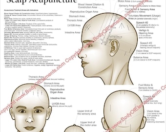 Scalp Acupuncture Points Areas Poster 18" X 24" Laminated or Paper Chinese Medicine TCM