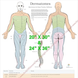 Poster Dermatomes, myotomes et DTR Tableau du système nerveux médical chiropratique plastifié ou papier. 20 po. X 30 po. et 24 po. X 36 po.