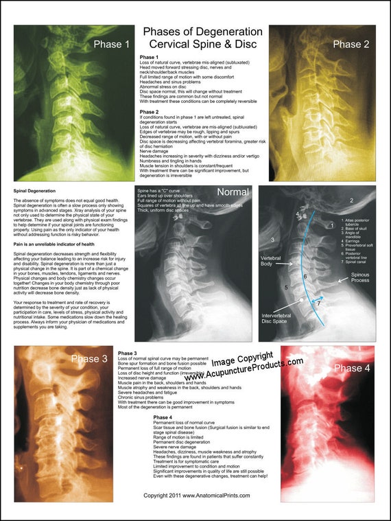 Vertebrae Chart Symptoms