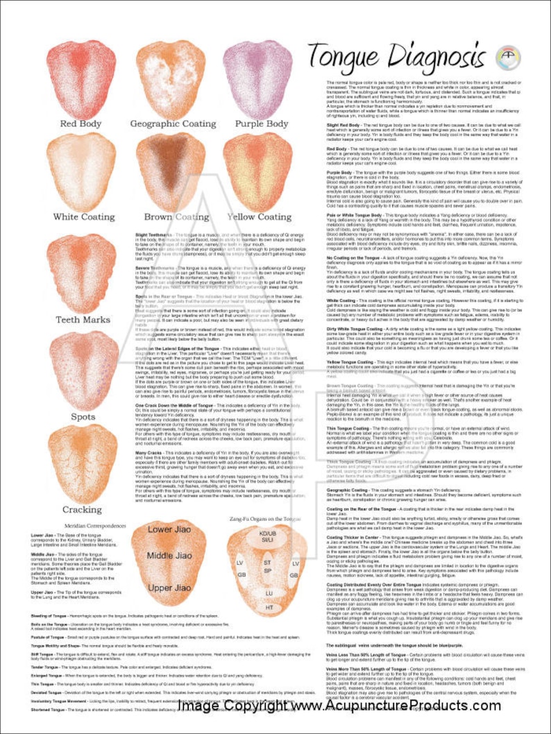 Chinese Tongue Diagnosis Poster 18 X 24 Etsy