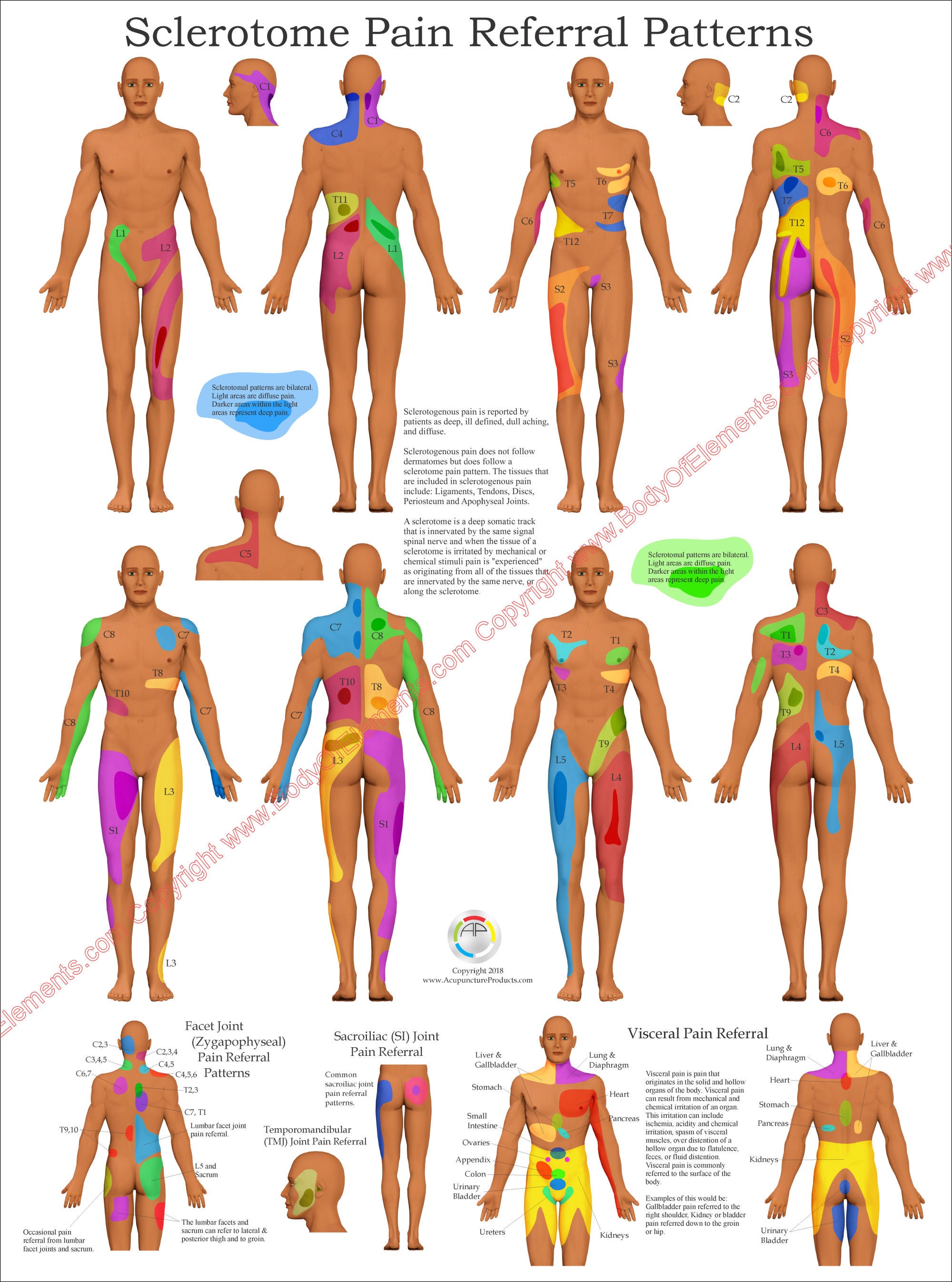 Sclerotome Pain 解剖図！カイロ！整体！鍼灸！エステ！トレーナー！ Sclerotome Visceral Pain Referral Chiropractic Poster 18