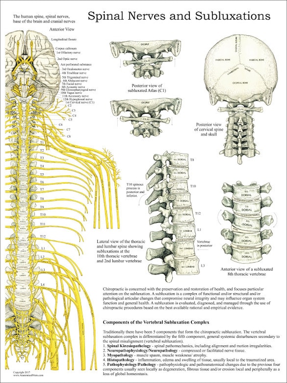 Sclerotome Visceral Pain Referral Poster 18/" X 24/" Chiropractic Chart